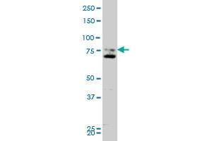 SMO monoclonal antibody (M11), clone 1D9 Western Blot analysis of SMO expression in A-431 . (SMO Antikörper  (AA 653-787))