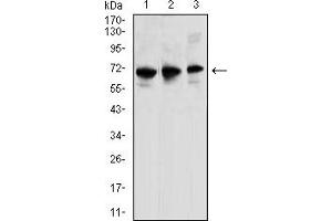 Western Blotting (WB) image for anti-Chemokine (C-C Motif) Receptor 6 (CCR6) antibody (ABIN7193565)