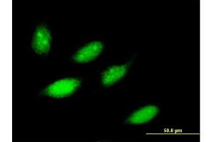 Immunofluorescence of purified MaxPab antibody to ZNF653 on HeLa cell.