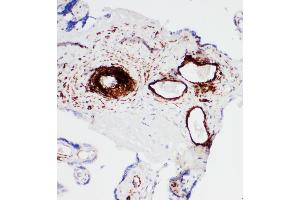 Anti-SERCA1 ATPase antibody, IHC(P) IHC(P): Human Placenta Tissue (ATP2A1/SERCA1 Antikörper  (Middle Region))