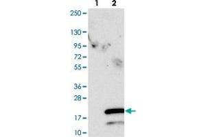 Western blot analysis of Lane 1: Negative control (vector only transfected HEK293T lysate). (SPCS1 Antikörper)