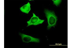 Immunofluorescence of purified MaxPab antibody to FASN on HeLa cell. (Fatty Acid Synthase Antikörper  (AA 1-439))