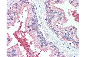 Anti-CADM2 antibody IHC of human prostate. (CADM2 Antikörper  (Extracellular Domain))