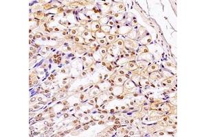Immunohistochemistry (Paraffin-embedded Sections) (IHC (p)) image for anti-MDS1 and EVI1 Complex Locus (MECOM) antibody (ABIN7074575)