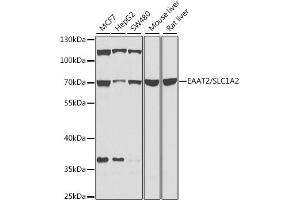 Western blot analysis of extracts of various cell lines, using E/E/SLC1 antibody (ABIN6129469, ABIN6147870, ABIN6147871 and ABIN6214022) at 1:1000 dilution. (SLC1A2 Antikörper  (AA 495-574))