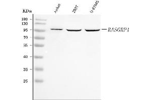 Western blot analysis of RASGRP1 using anti-RASGRP1 antibody (ABIN7602498).