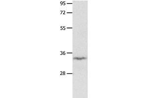 Western Blot analysis of Mouse brain tissue using IGFBP7 Polyclonal Antibody at dilution of 1:400 (IGFBP7 Antikörper)