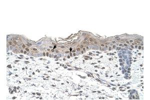 Arrestin B2 antibody was used for immunohistochemistry at a concentration of 4-8 ug/ml to stain Squamous epithelial cells (arrows) in Human Skin. (Arrestin 3 Antikörper  (Middle Region))