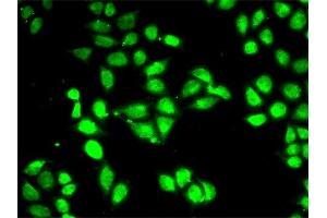 Immunofluorescence (IF) image for anti-Proteasome (Prosome, Macropain) 26S Subunit, ATPase, 3 (PSMC3) antibody (ABIN1874383) (PSMC3 Antikörper)