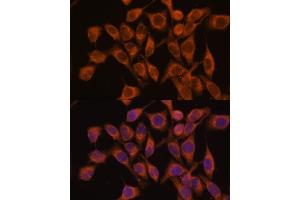Immunofluorescence analysis of HeLa cells using UBQLNL antibody (ABIN7271125) at dilution of 1:100. (UBQLNL Antikörper  (AA 176-475))