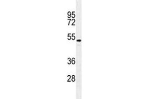 TGFB2 antibody western blot analysis in A549 lysate. (TGFB2 Antikörper)