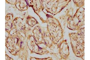 Immunohistochemistry (IHC) image for anti-Cytochrome P450, Family 19, Subfamily A, Polypeptide 1 (CYP19A1) antibody (ABIN7127445)