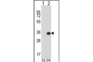 Western blot analysis of CNOT8 (arrow) using rabbit polyclonal CNOT8 Antibody (N-term) (ABIN656816 and ABIN2846030). (CNOT8 Antikörper  (N-Term))