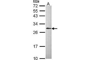 WB Image Sample (30 ug of whole cell lysate) A: Hep G2 , 12% SDS PAGE antibody diluted at 1:1000 (DCXR Antikörper  (C-Term))