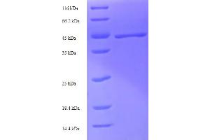 SDS-PAGE (SDS) image for Green Fluorescent Protein (GFP) (AA 1-238), (full length) protein (His-SUMO Tag) (ABIN5710910) (GFP Protein (AA 1-238, full length) (His-SUMO Tag))