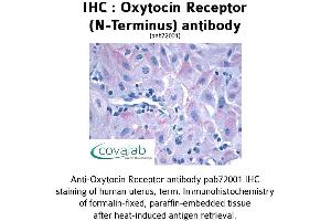 Image no. 1 for anti-Oxytocin Receptor (OXTR) (Extracellular Domain), (N-Term) antibody (ABIN1737739) (Oxytocin Receptor Antikörper  (Extracellular Domain, N-Term))