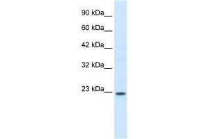 WB Suggested Anti-HOXB6 Antibody Titration: 0. (HOXB6 Antikörper  (N-Term))