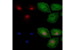 Phospho-Gli2 (Ser149) Antibody staining A549 cells(4h of LPS treatment) by IF/ICC. (GLI2 Antikörper  (pSer149))