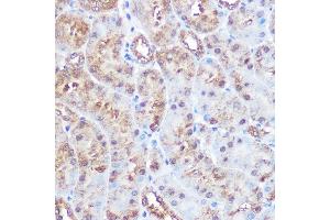 Immunohistochemistry of paraffin-embedded mouse kidney using ERK5 Rabbit mAb (ABIN1680723, ABIN3018327, ABIN3018328 and ABIN7101595) at dilution of 1:100 (40x lens). (MAPK7 Antikörper)