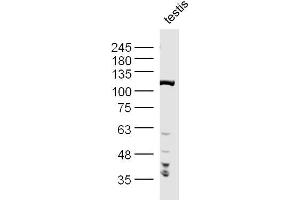 Image no. 3 for anti-Protein Phosphatase 1, Regulatory (Inhibitor) Subunit 10 (PPP1R10) (AA 151-250) antibody (ABIN1386277)
