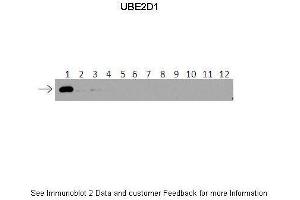 Lanes:   1: 40ng HIS-UBE2D1 protein 2: 40ng HIS-UBE2D2 protein 3: 40ng HIS-UBE2D3 protein 4: 40ng HIS-UBE2D4 protein 5: 40ng HIS-UBE2E1 protein 6: 40ng HIS-UBE2E2 protein 7: 40ng HIS-UBE2E3 protein 8: 40ng HIS-UBE2K protein 9: 40ng HIS-UBE2L3 protein 10: 40ng HIS-UBE2N protein 11: 40ng HIS-UBE2V1 protein 12: 40ng HIS-UBE2V2 protein. (UBE2D1 Antikörper  (Middle Region))