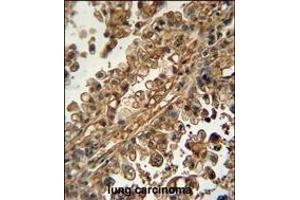 Immunohistochemistry (Paraffin-embedded Sections) (IHC (p)) image for anti-ATP-Binding Cassette, Sub-Family G (WHITE), Member 1 (ABCG1) (AA 168-195), (N-Term) antibody (ABIN390432)