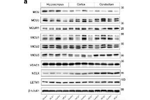 Western blot for mitochondrial Ca 2+ uptake proteins in hippocampus,cortex and cerebellum lysates from 6 month old contol mice (Control) and mice with haploinsufficiency of the mitochondrial Ca2+ uniporter (MCU+/-).