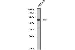 Western blot analysis of extracts of U-251MG cells using RFFL Polyclonal Antibody at dilution of 1:1000. (RFFL Antikörper)