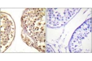 Immunohistochemistry analysis of paraffin-embedded human testis tissue, using c-Jun (Ab-231) Antibody.