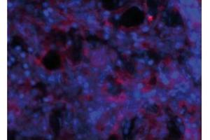 anti-Prothymosin alpha 1 (AA 101-109) antibody