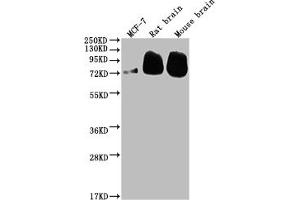 Western Blot Positive WB detected in: MCF-7 whole cell lysate, Rat brain tissue, Mouse brain tissue All lanes: BACE1 antibody at 1:2000 Secondary Goat polyclonal to rabbit IgG at 1/50000 dilution Predicted band size: 56, 53, 52, 49, 46, 43 kDa Observed band size: 72 kDa (Rekombinanter BACE1 Antikörper)