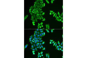 Immunofluorescence analysis of HeLa cell using ACSS2 antibody. (ACSS2 Antikörper)