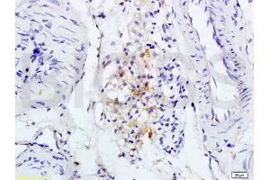 L1 rat brain lysates L2 rat kidney lysates probed with Anti IL-1R1/CD121a/IL1 Receptor I Polyclonal Antibody, Unconjugated (ABIN747743) at 1:200 overnight at 4 °C. (IL1R1 Antikörper  (AA 481-569))