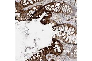 Immunohistochemical staining of human colon with BCORL1 polyclonal antibody  shows strong cytoplasmic and membranous positivity in glandular cells. (BCORL1 Antikörper)