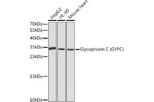 Western blot analysis of extracts of various cell lines, using Glycophorin C (Glycophorin C (GYPC)) antibody (ABIN3021795, ABIN3021796, ABIN3021797 and ABIN6215928) at 1:1000 dilution. (CD236/GYPC Antikörper  (AA 1-128))