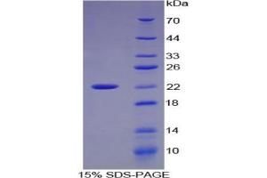 SDS-PAGE analysis of Cow Matrix Metalloproteinase 9 (MMP9) Protein.