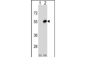 Western blot analysis of COCH (arrow) using rabbit polyclonal COCH Antibody (Center) (ABIN656833 and ABIN2846042). (COCH Antikörper  (AA 399-428))
