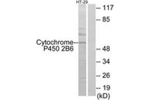 Western blot analysis of extracts from HT-29 cells, using Cytochrome P450 2B6 Antibody. (CYP2B6 Antikörper  (AA 241-290))