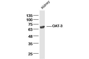 Mouse kidney lysates probed with OAT-3 Polyclonal Antibody, Unconjugated  at 1:300 dilution and 4˚C overnight incubation. (SLC22A8 Antikörper  (AA 31-110))
