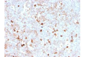 Immunohistochemistry (IHC) image for anti-CD14 (CD14) (AA 25-148) antibody (ABIN6941088)