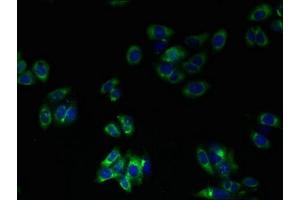 Immunofluorescent analysis of HepG2 cells using ABIN7173211 at dilution of 1:100 and Alexa Fluor 488-congugated AffiniPure Goat Anti-Rabbit IgG(H+L) (TMEM41A Antikörper  (AA 18-66))