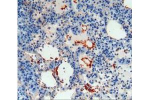 IHC-P analysis of lung tissue, with DAB staining. (Thrombomodulin Antikörper  (AA 31-167))