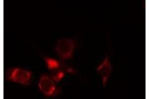 ABIN6275262 staining Hela cells by IF/ICC. (MYOM2 Antikörper  (Internal Region))