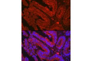 Immunofluorescence analysis of human colon carcinoma using OLFM4 Rabbit pAb (ABIN7269084) at dilution of 1:500 (40x lens). (Olfactomedin 4 Antikörper  (AA 211-510))
