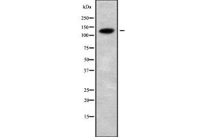 Western blot analysis of CATSPERB using COLO205 whole cell lysates (CATSPERB Antikörper  (C-Term))