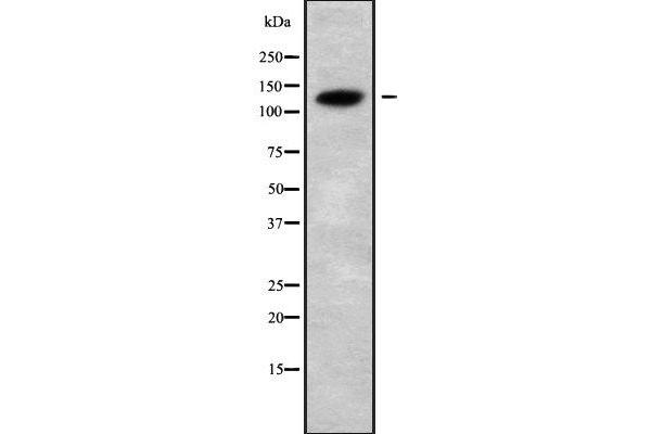 CATSPERB anticorps  (C-Term)
