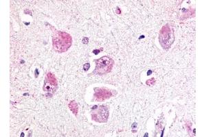 Immunohistochemical staining of Brain (Neurons and glia) using anti- RXFP3 antibody ABIN122238 (Relaxin 3 Receptor 1 Antikörper  (Cytoplasmic Domain))