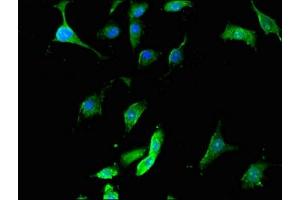 Immunofluorescent analysis of U251 cells using ABIN7168861 at dilution of 1:100 and Alexa Fluor 488-congugated AffiniPure Goat Anti-Rabbit IgG(H+L) (Septin 12 Antikörper  (AA 1-358))