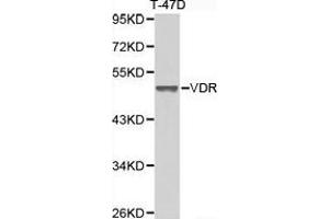 Western Blotting (WB) image for anti-Vitamin D Receptor (VDR) antibody (ABIN1875322) (Vitamin D Receptor Antikörper)