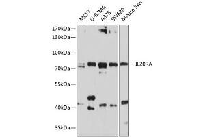 Western blot analysis of extracts of various cell lines, using IL20RA antibody (ABIN6129281, ABIN6142355, ABIN6142356 and ABIN6214512) at 1:1000 dilution. (IL20RA Antikörper)